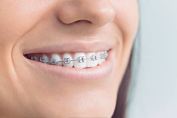Why Choose Us for Your Dental Needs in Beverly Hills, TX